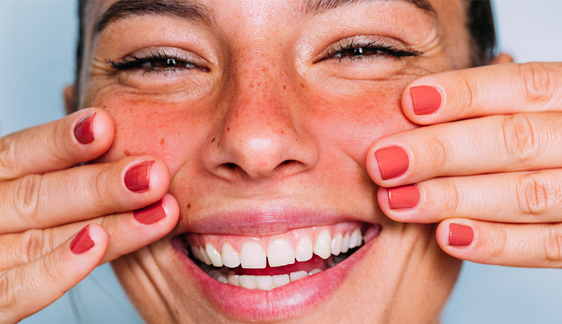 'Jeg er hudlege, og det er dette jeg vil at du skal vite om forskjellen mellom kviser og rosacea'