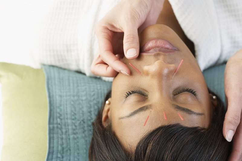 L'acupuncture va officiellement le courant dominant mais cela fonctionnera pour vous?