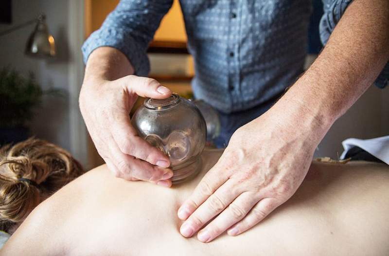 5 go-to-spots voor cupping-therapie in NYC