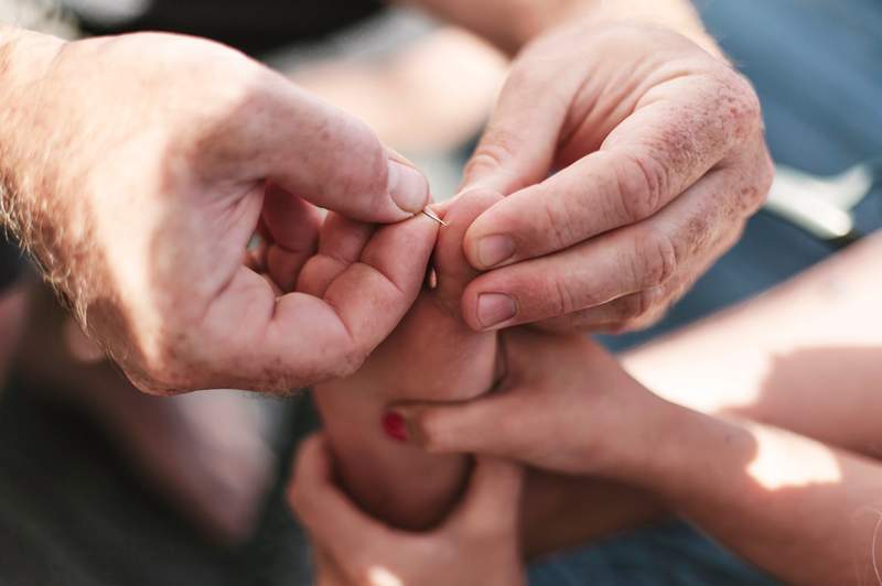 Ecco esattamente cosa fare per una scheggia, poiché l'estate è la stagione per andare a piedi nudi