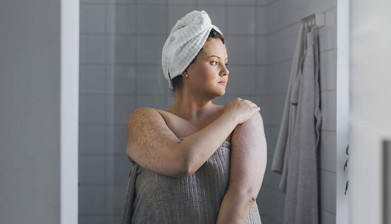 Si vous avez une peau sèche, les cères vous supplient de faire ces ajustements à votre routine de douche