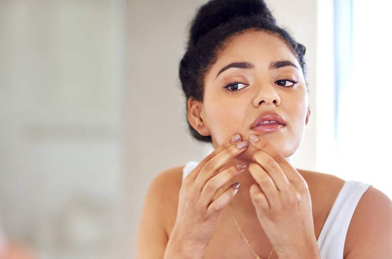 Alguna vez obtenga Zits peludos? Un derm explica lo que esto significa