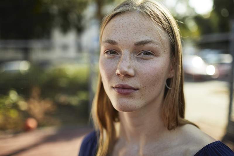 Jestem dermatologiem i jest to najbardziej błędnie zdiagnozowany stan skóry, jaki widzę