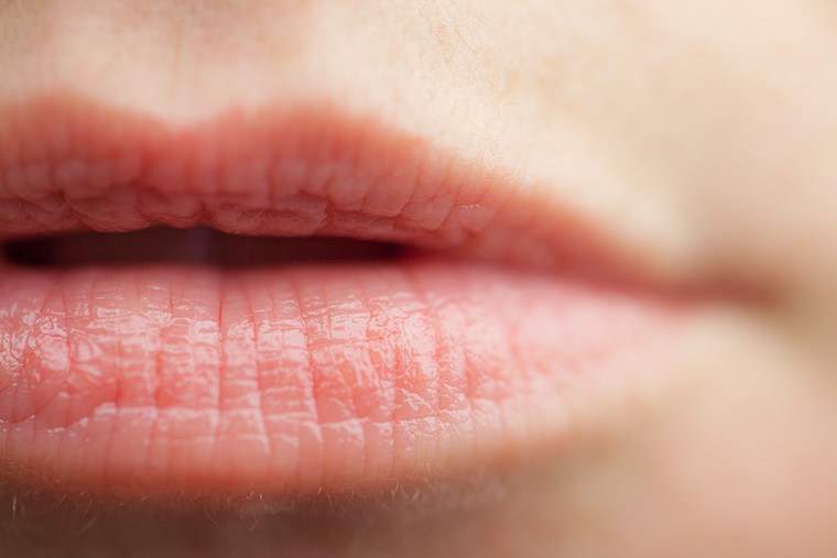 6 Tipps, wie man gerissene Lippen losgeht