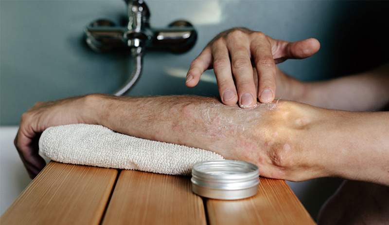 Sono un dermatologo e queste 7 cose potrebbero peggiorare la tua psoriasi