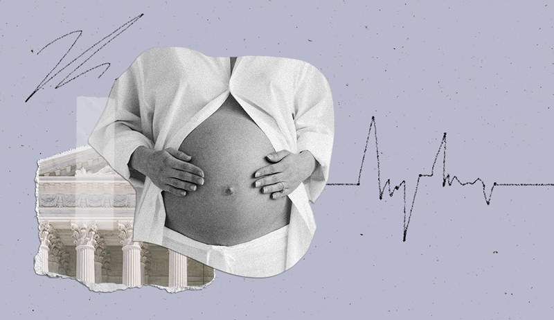 Waarom doula's belangrijker dan ooit zijn in het post-Roe-tijdperk