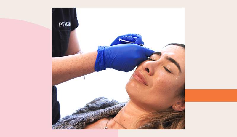 Si vous songez à obtenir du Botox, voici tout ce que vous devez savoir sur le processus