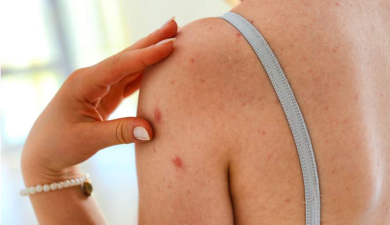 Sono un dermatologo, e questi sono gli 8 migliori prodotti per combattere e prevenire la pancia